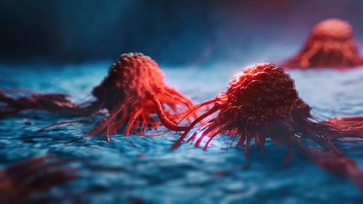 Research shows how tumors exploit crucial nutrient to avoid immune response