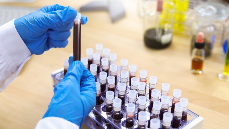 Recent Advances in Hemophilia Treatment: Exploring Innovative Techniques and Research